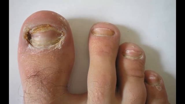 Фитнес для будущих мам