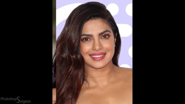 PRIYANKA CHOPRA: Before And After Plastic Surgery