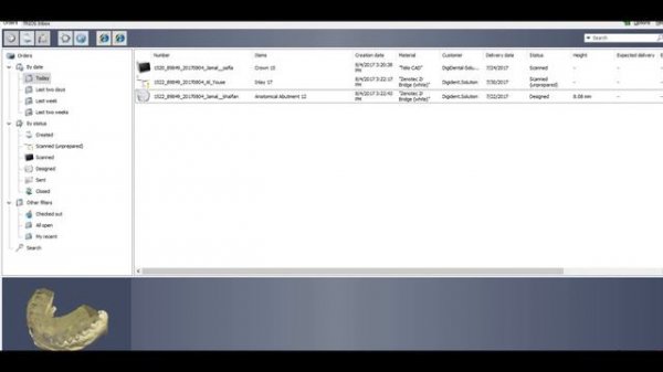 import and export order in 3shape Dental Designer