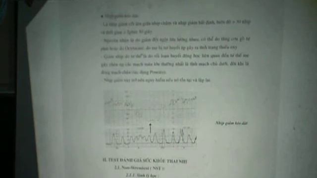 DSCF9993 MONITOR 6 смотреть онлайн