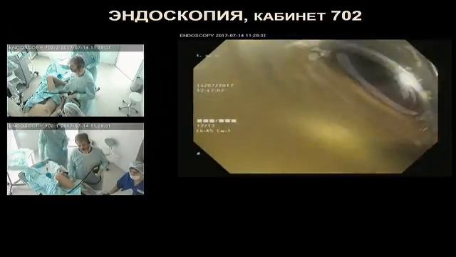 Диагностическая эндоскопия с NBI. Толстая кишка. Интерактивный семинар смотреть онлайн