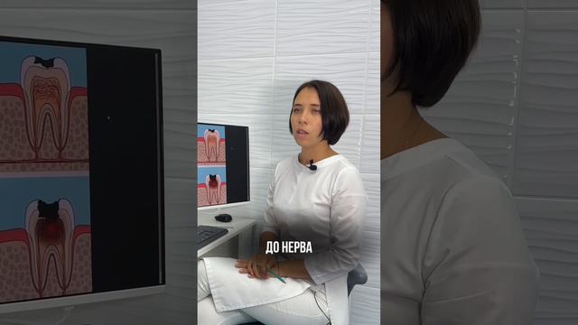 Что будет ЕСЛИ ТЕРПЕТЬ зубную БОЛЬ?! #боль #зубнаяболь #зубы #кариес #стоматология #москва #польза смотреть онлайн