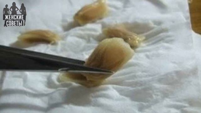 Вот как вырастить лимон в чашке — чтобы дома всегда идеально пахло! смотреть онлайн