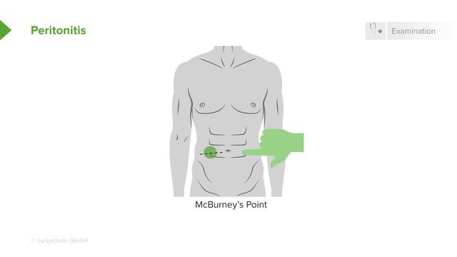 Acute Abdomen, Appendicitis & Peritonitis – General Surgery | Lecturio смотреть онлайн