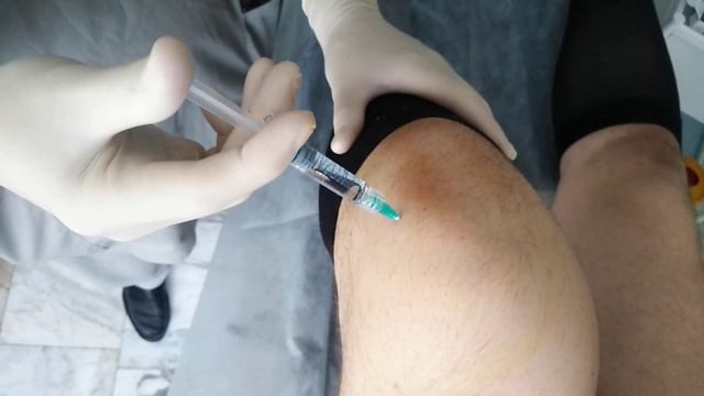 Укол гиалуроновой кислоты в коленный сустав смотреть онлайн