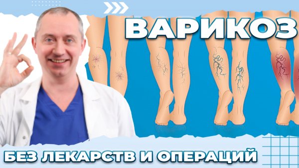 Варикоз! Без лекарств и операций. Лечение варикозной болезни нижних конечностей.