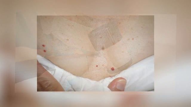 Вот ЧТО означают КРАСНЫЕ РОДИНКИ на КОЖЕ! смотреть онлайн