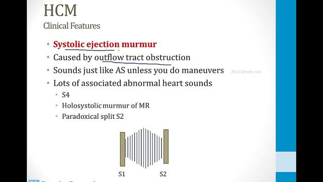 Cardiology - 9. Other Cardiovascular Topics - 6.Hypertrophic Cardiomyopathy Atf