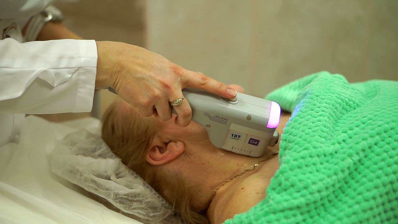 Старение шеи и средства омоложения этой деликатной зоны. смотреть онлайн