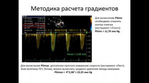 Основы эхокардиографии: ГРАДИЕНТ ДАВЛЕНИЯ