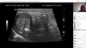 УЗИ как инструмент визуальной диагностики в ветеринарии