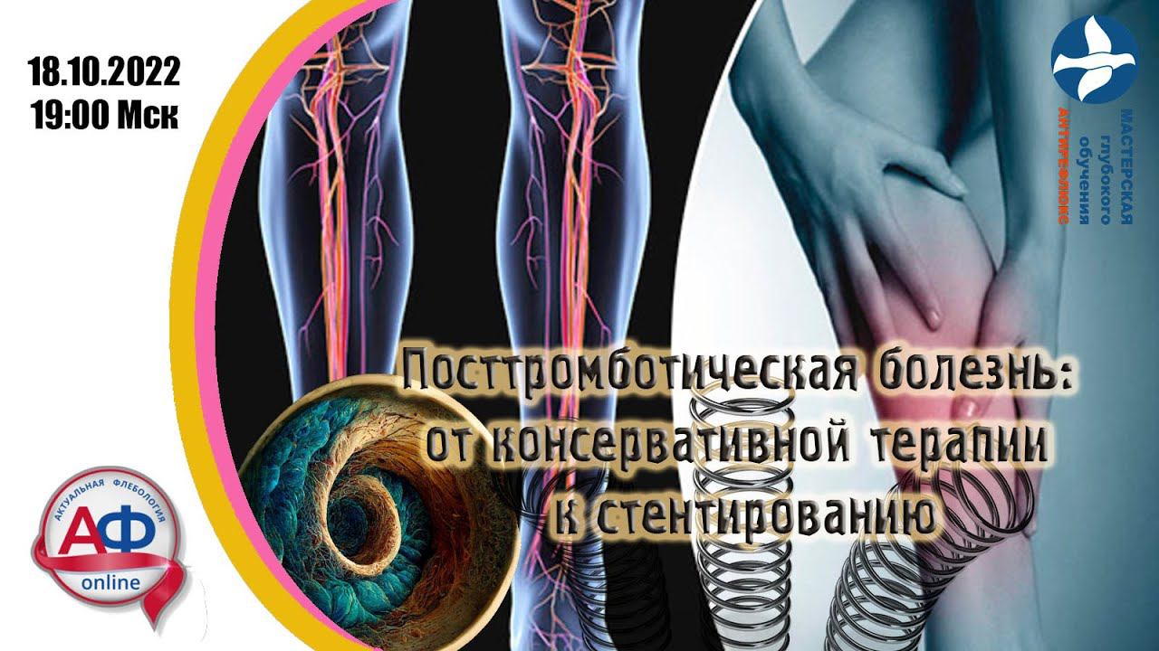 Посттромботическая болезнь: от консервативной терапии к стентированию. смотреть онлайн