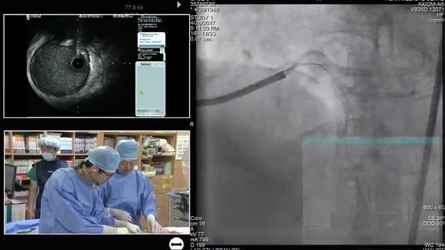 [TCTAP 2017] Coronary Symposium - Live Case Session III смотреть онлайн