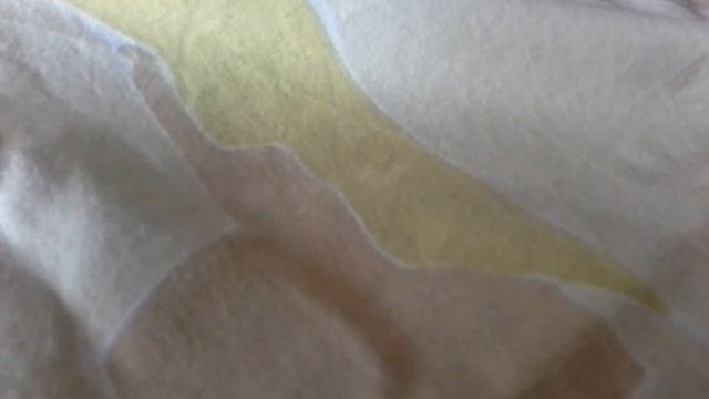 Нашего боню укусила собака. смотреть онлайн