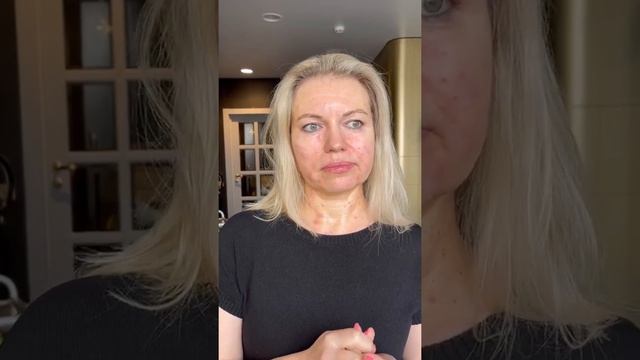 Вся правда об Эффезеле при розацеа. Реальный отзыв пациента с розацеа смотреть онлайн