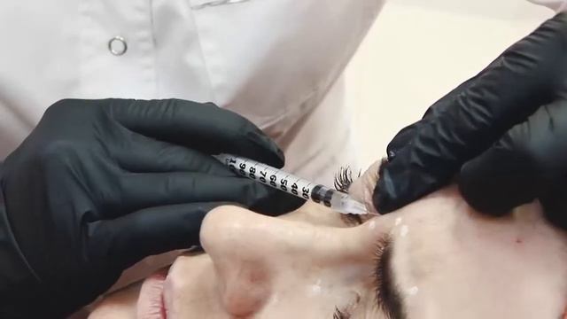 Ксеомин: индивидуальный подход. Две модели. смотреть онлайн