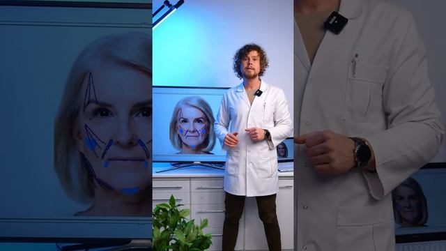 Экспресс-протокол Full Face с помощью мезонитей Barb Spiral и нитей «Сеток» смотреть онлайн