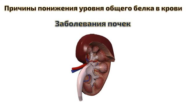 общий белок в крови понижен что это значит смотреть онлайн