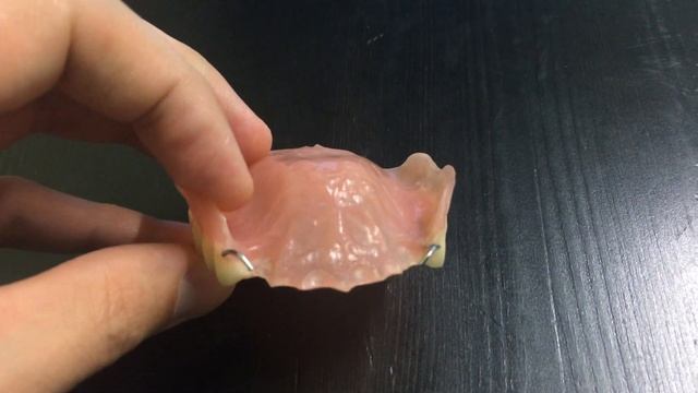 Итальянский частичный съемный зубной протез смотреть онлайн