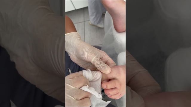 Аппаратный педикюр. Обработка одной фрезой. Правильная обработка это 50% успеха смотреть онлайн