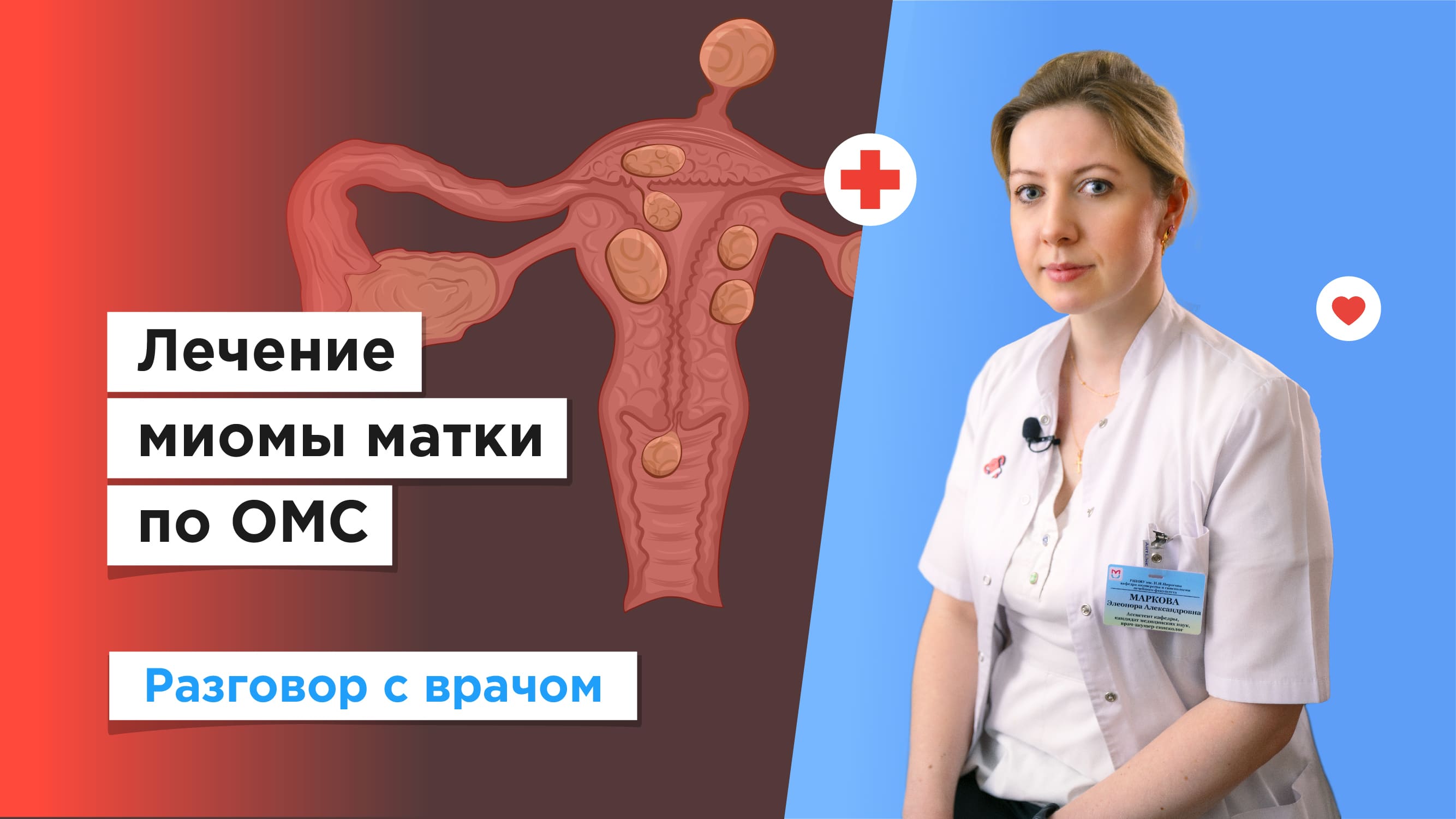 Лечение миомы матки бесплатно по ОМС смотреть онлайн
