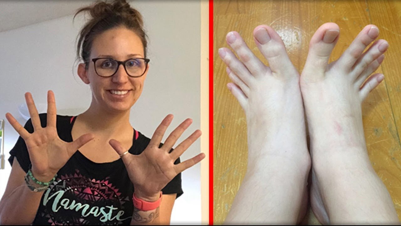 10 Заболеваний, Которые Дают Людям Суперспособности смотреть онлайн