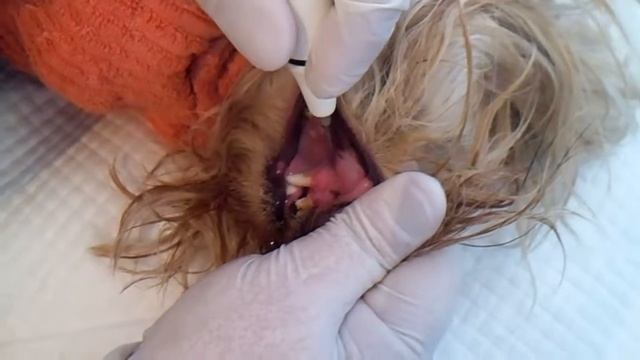 чистка зубов ультразвуком смотреть онлайн