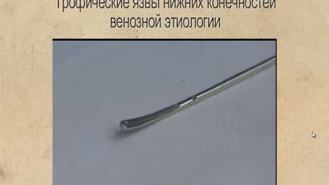 ХВН смотреть онлайн