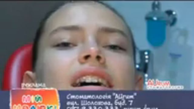 Элайнеры смотреть онлайн