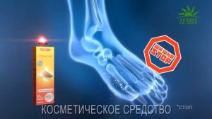 Крем от шишек на больших пальцах ног «Акулий жир и лавр благородный»
