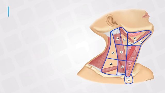 Neck Lymph Nodes and Cancer Detection: A Crucial Diagnostic Tool смотреть онлайн