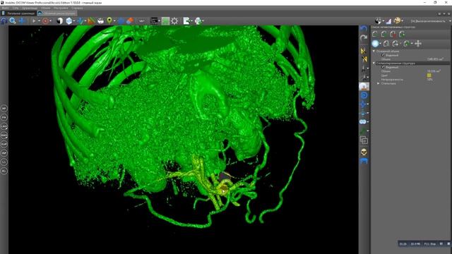 Segmentation by mask in 3D смотреть онлайн