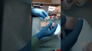 Цементировка коронки