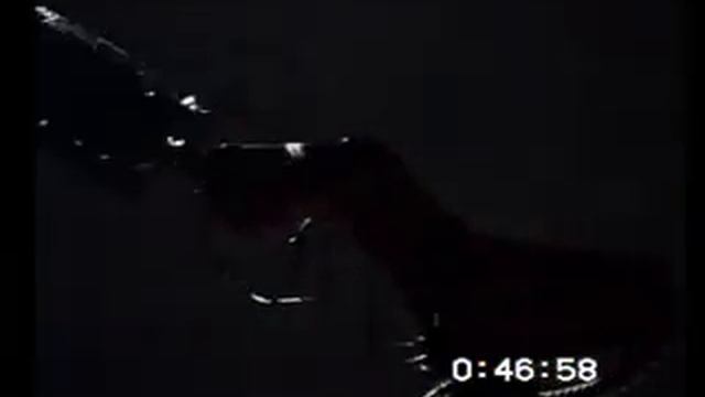 Stelarc “The Third Hand” 1992