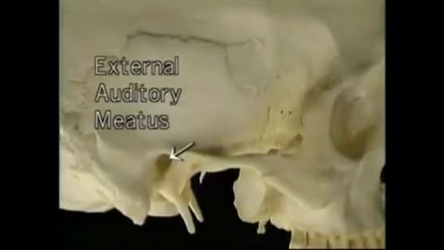 Анатомия костей черепа.Височная кость. Разбор с профессором Акландом. смотреть онлайн