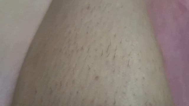 Избавилась от волос навсегда | DYKEMANN CLEAR S 46