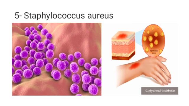Top 10 Most Dangerous Bacteria according to WHO, Bacterial Infections. @pharmamedicalknowledge смотреть онлайн