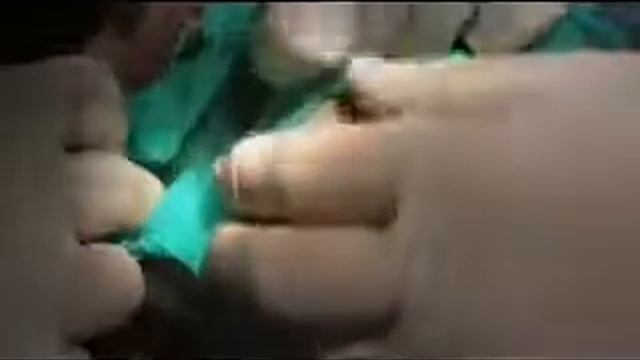 Эстетическая реставрация зубов смотреть онлайн