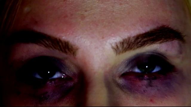 Квест"ЛОБОТОМИЯ" от компании "World of Quests" смотреть онлайн