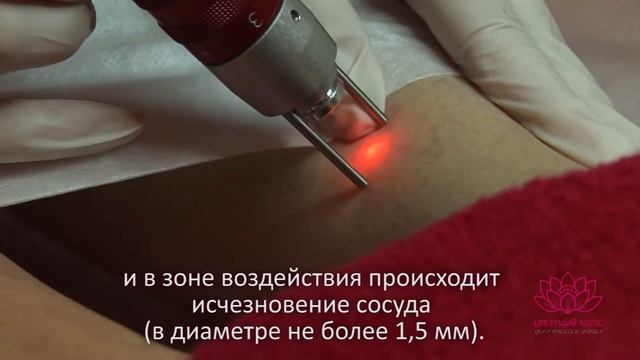 Цветущий лотос. Фото и лазеротерапия смотреть онлайн