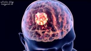 ЧАГА или Как Солженицын вылечил  РАК чагой! Уникальные лечебные свойства березового гриба чага!