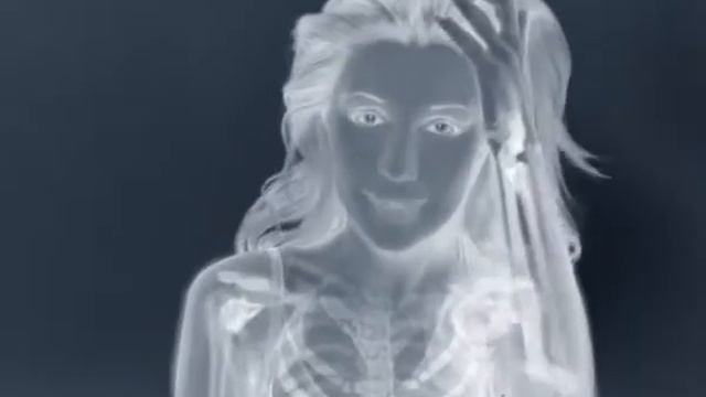 Calcium Complivit bones 20 смотреть онлайн