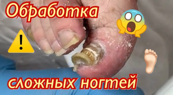 Обработка сложных ногтей ?⚠️???