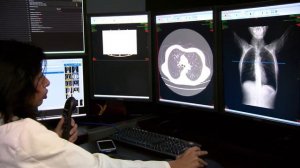 Компьютерная томография (КТ) позвоночника