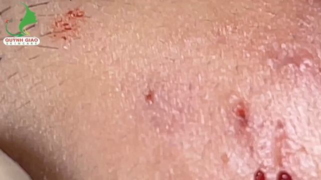 Relax Skincare Everyday with QuynhGiao Beauty Spa #255 смотреть онлайн