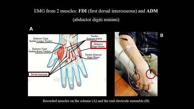 Маттео Феурра: 