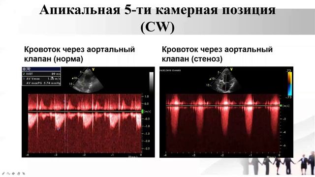 7 ЭХОКГ.mp4 смотреть онлайн