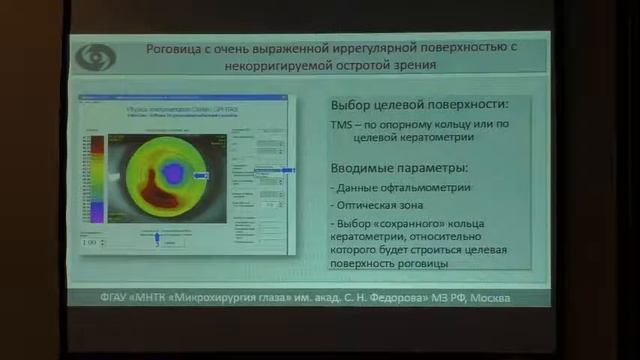 Коррекции иррегулярного астигматизма у пациентов с постинфекционными помутнениями роговицы