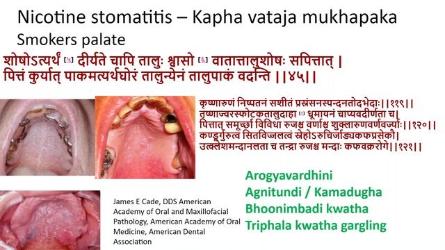 GIT disorders part 1 01 04 23 смотреть онлайн