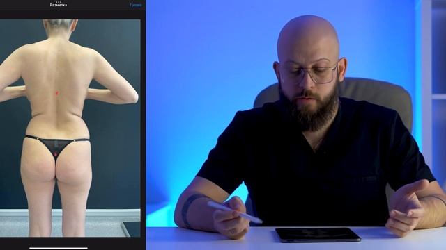 Как быстро УБРАТЬ ЖИВОТ, БОКА и УМЕНЬШИТЬ БЕДРА без диет и тренировок. Липосакция живота, боков, ног смотреть онлайн